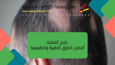 علاج الثعلبة